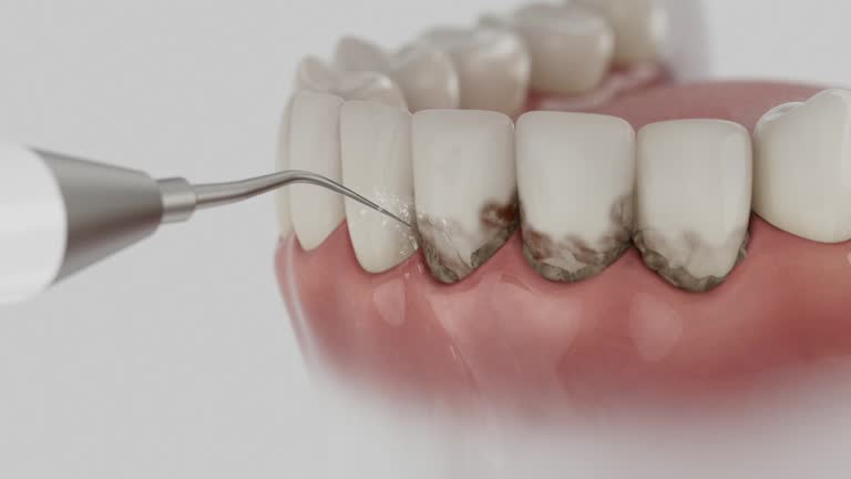Reliable Emergency Dentist contractor in Bells, TN by Smile Center Dentistry